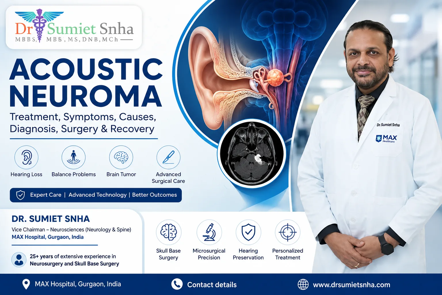 Acoustic Neuroma Treatment Symptoms Causes Diagnosis Surgery Recovery Guide