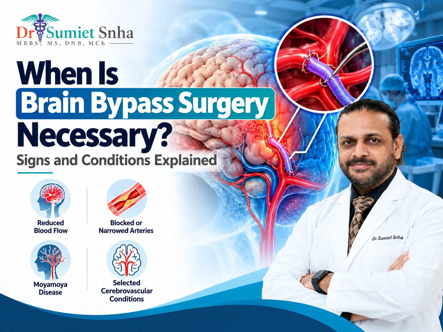 Brain Bypass Surgery medical illustration showing cerebral blood flow, blocked brain arteries, moyamoya disease, and Dr. Sumiet Snha, neurosurgeon.