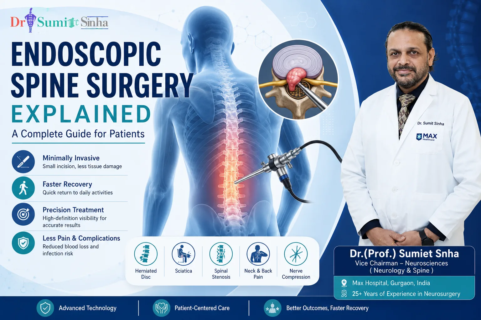 Endoscopic Spine Surgery Explained: A Complete Guide for Patients