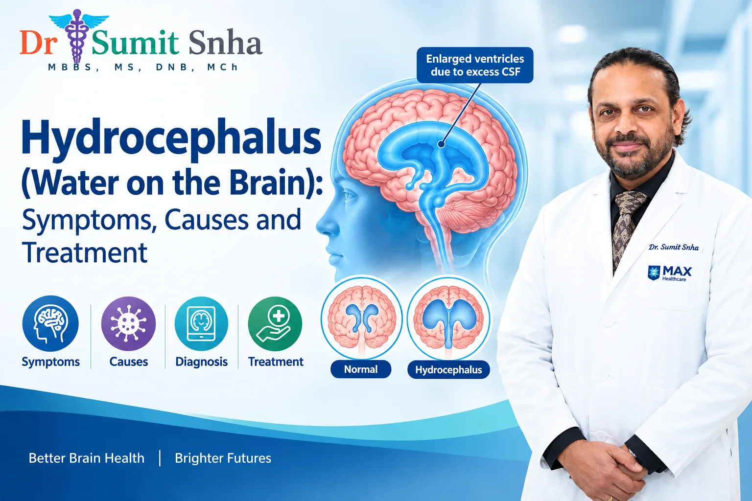 Medical infographic showing hydrocephalus (water on the brain), enlarged brain ventricles, symptoms, causes, diagnosis, and treatment options, featuring Dr. Sumiet Snha.