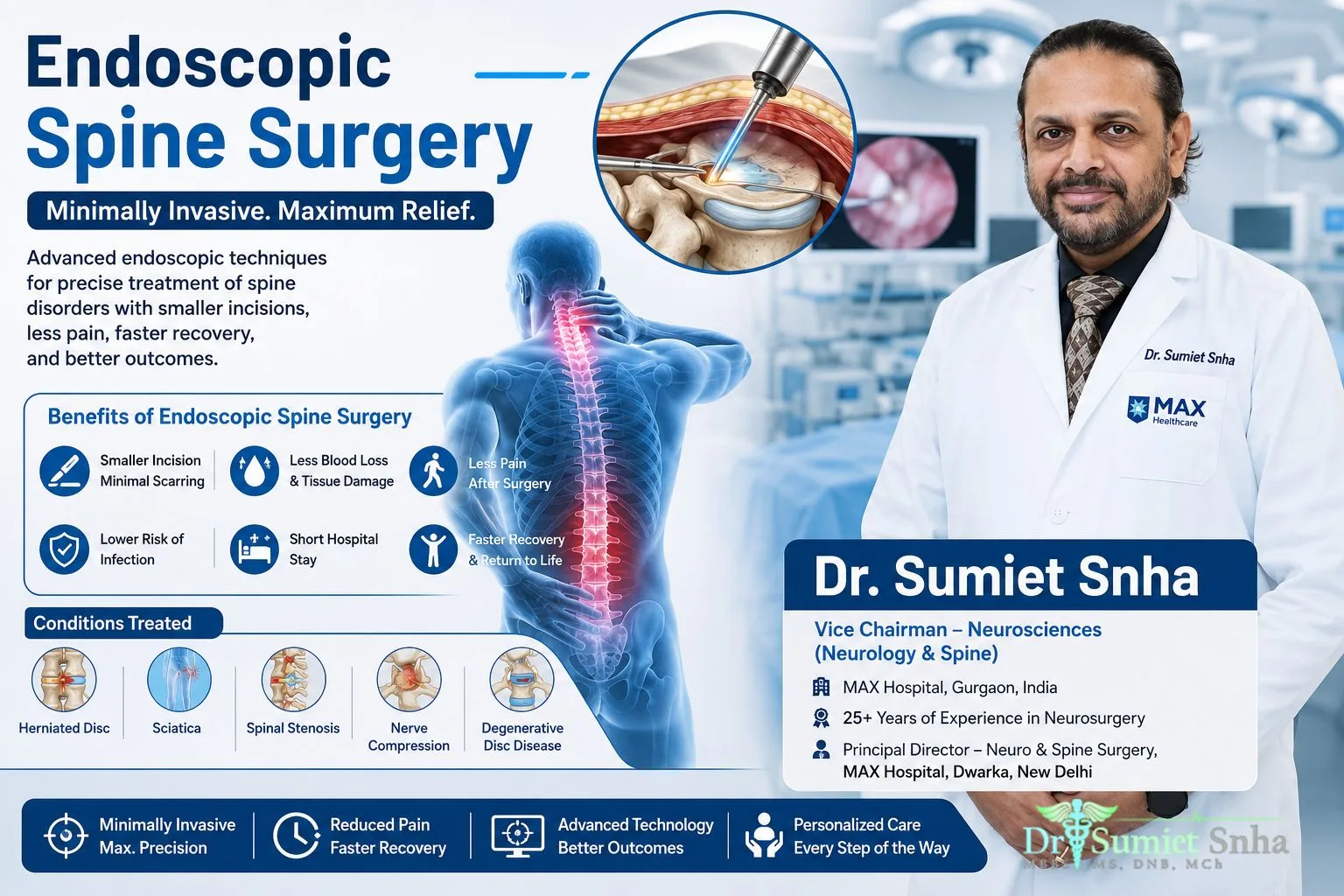 Endoscopic Spine Surgery Modern Treatment for Back and Neck Pain with Faster Recovery