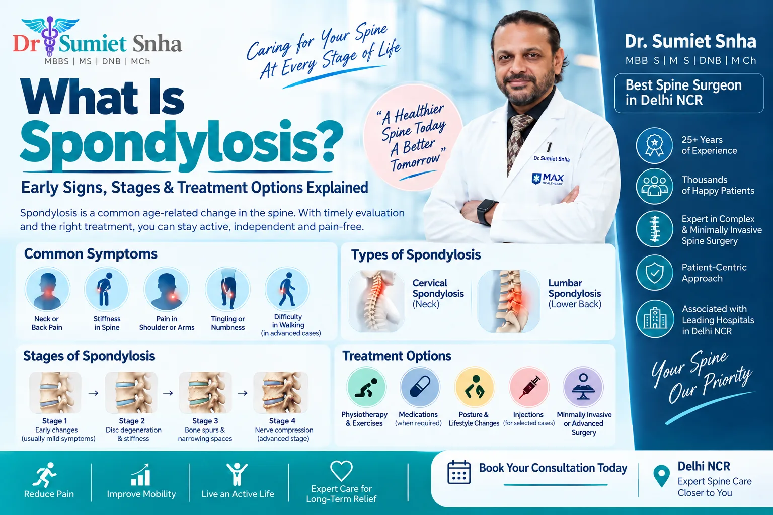 What Is Spondylosis? Early Signs, Stages & Treatment Options