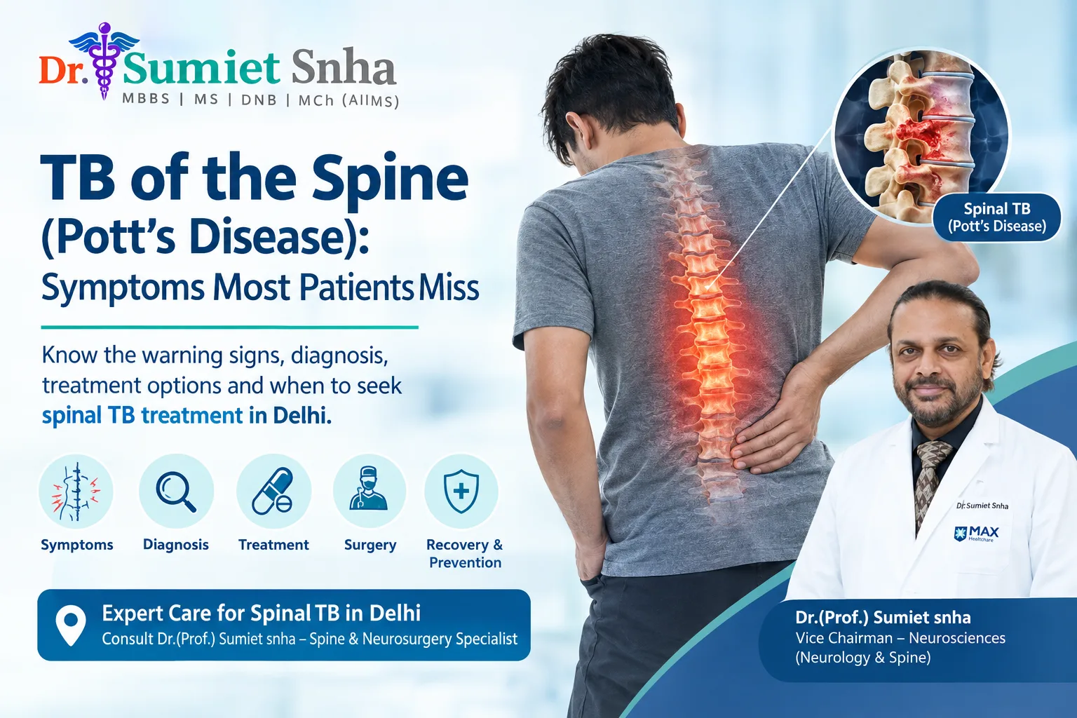 TB of the Spine Potts Disease Symptoms Most Patients Miss