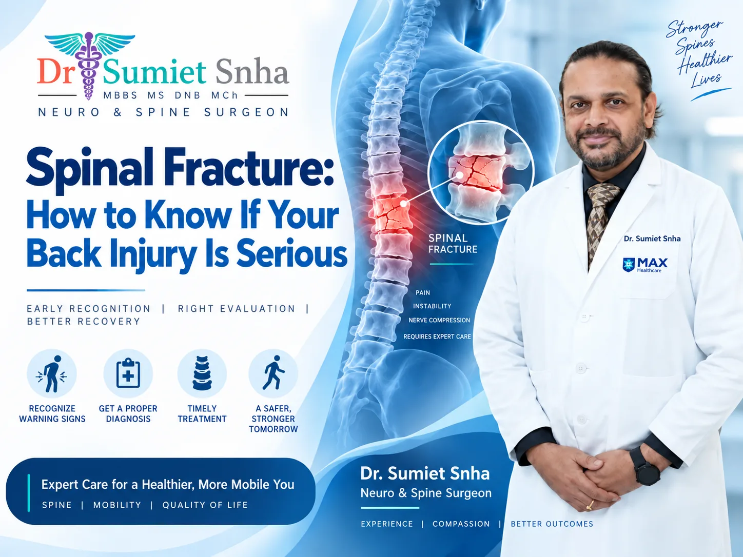 Spinal Fracture: How to Know If Your Back Injury Is Serious