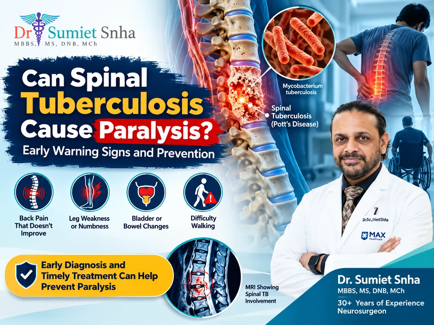 Can spinal tuberculosis cause paralysis? Medical illustration showing Pott's disease, spinal cord compression, early warning signs, and Dr. Sumiet Snha.