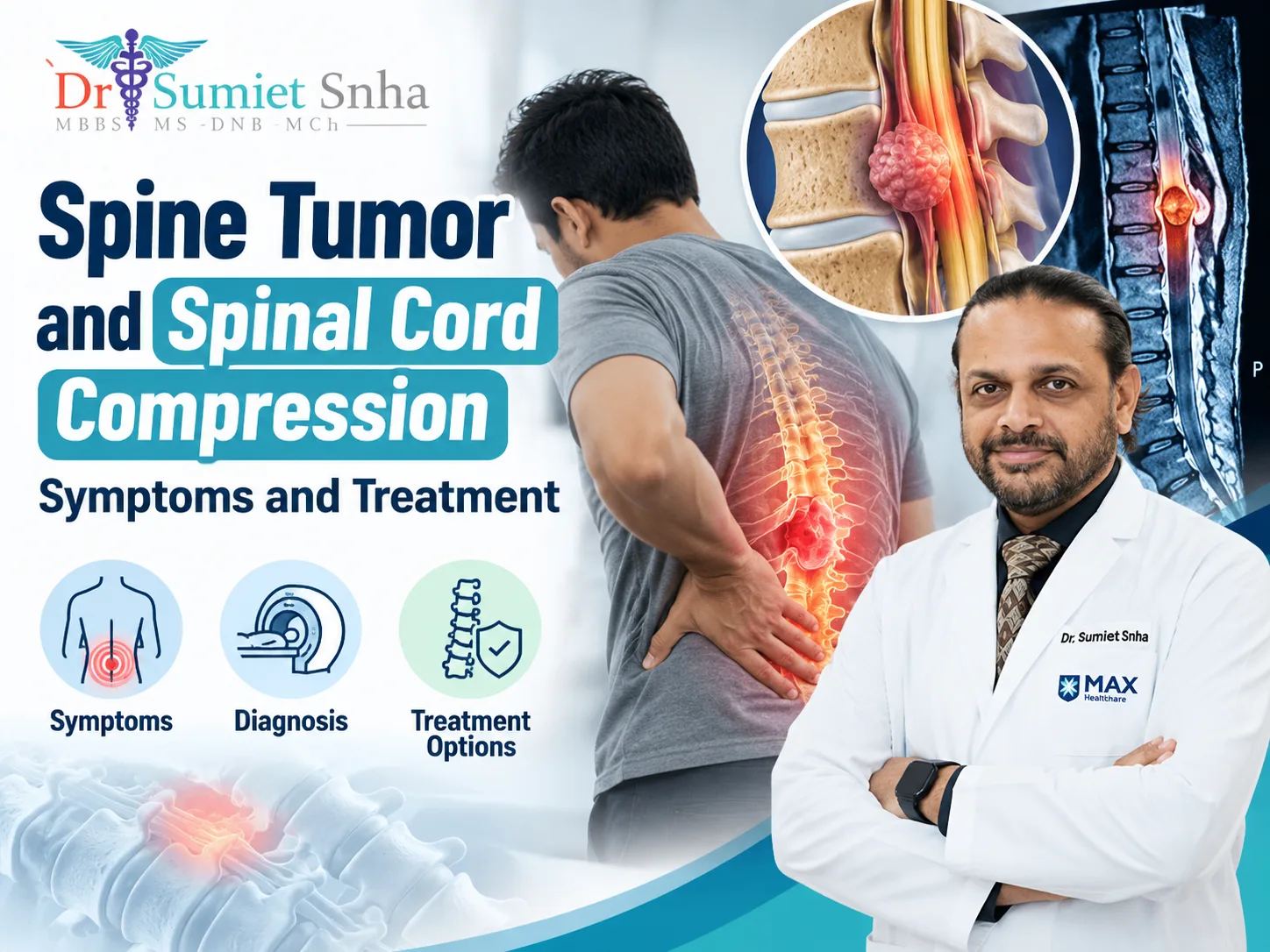 Spine Tumor and Spinal Cord Compression: Symptoms and Treatment