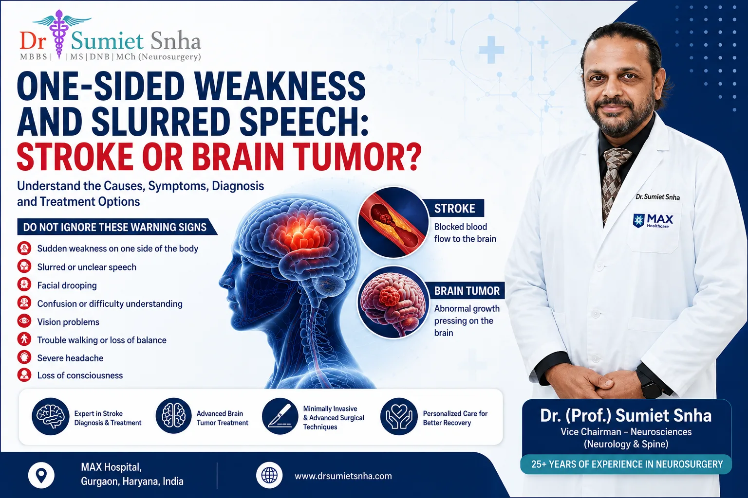 One-Sided Weakness and Slurred Speech Stroke or Brain Tumor