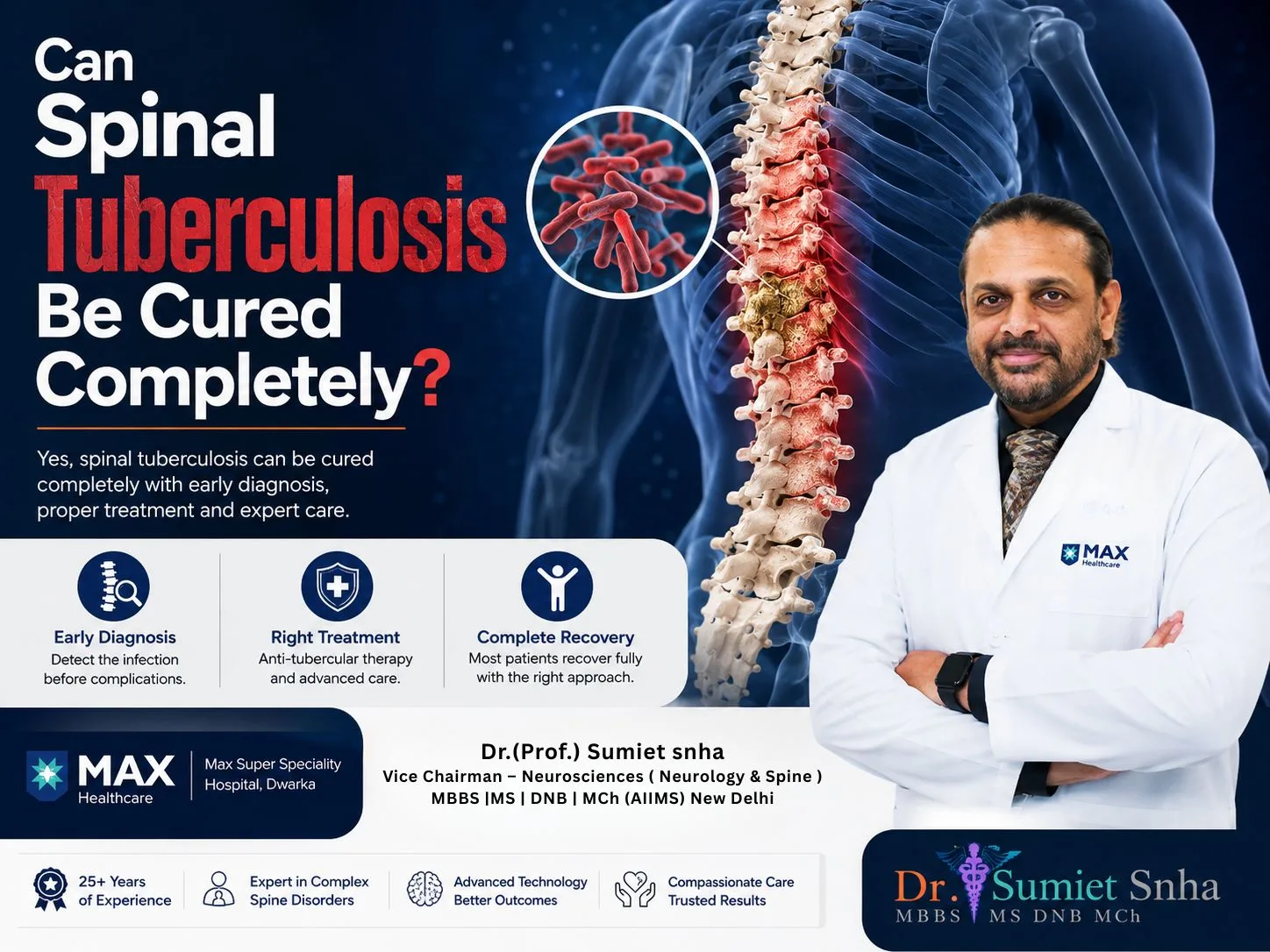 Can Spinal Tuberculosis Be Cured Completely