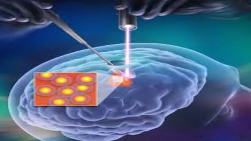 Acoustic Neuroma Treatment in Delhi