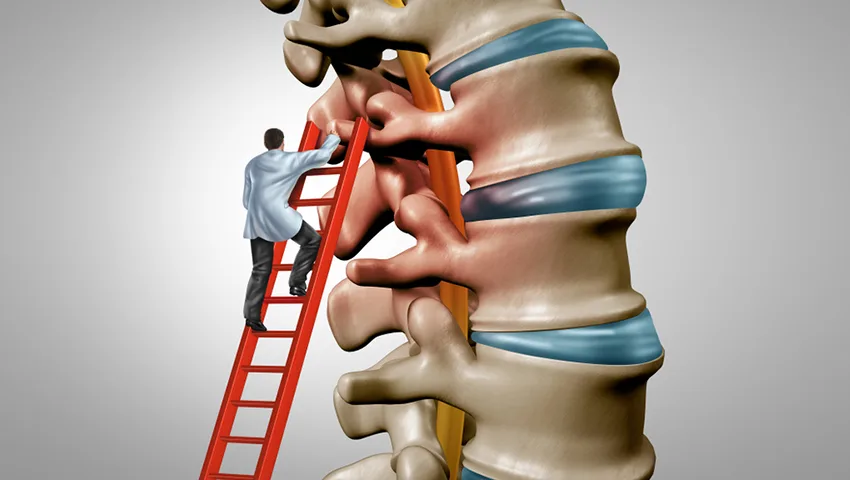 Endoscopic Spinal Stenosis Surgery in Delhi